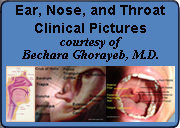 Ear, Nose, and Throat Clinical Pictures courtsey of Bechara Ghorayeb, M.D.